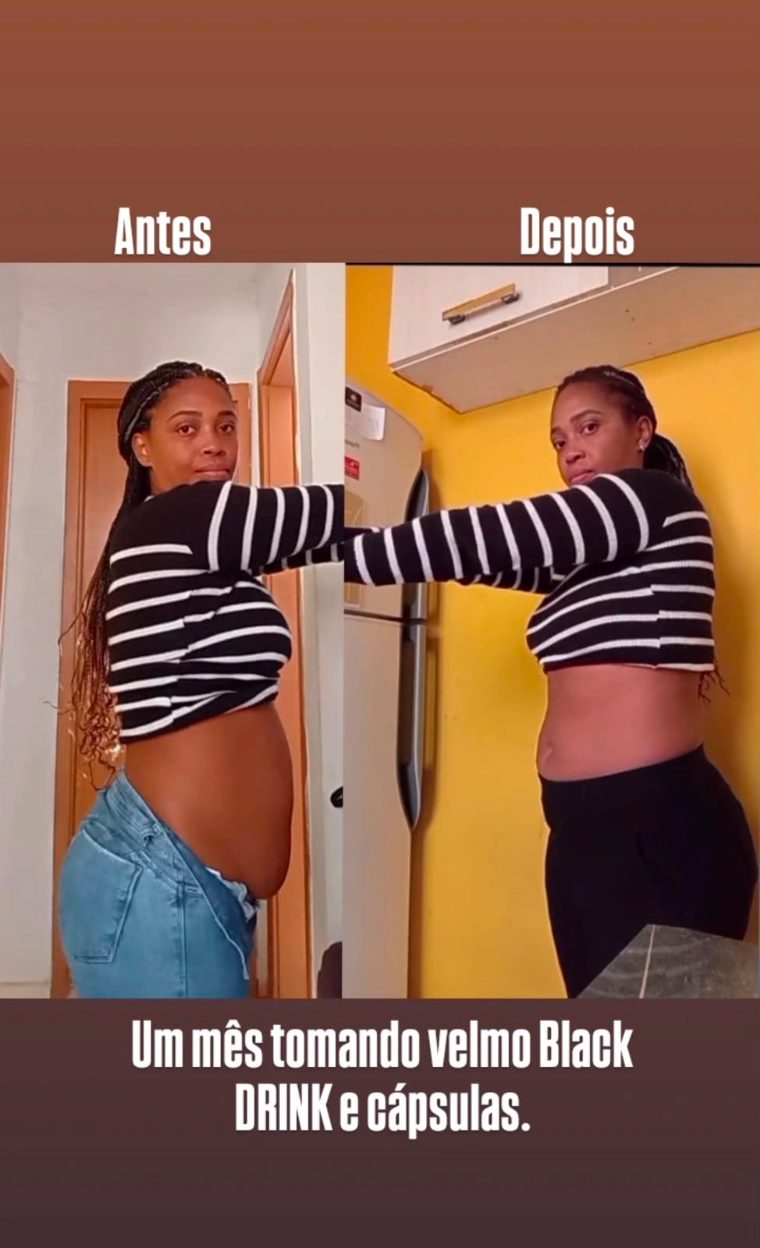 Antes e depois de cliente 5