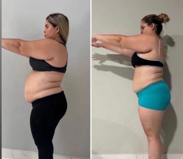 Antes e depois de cliente 7