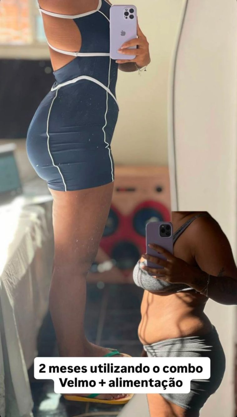 Antes e depois de cliente 13