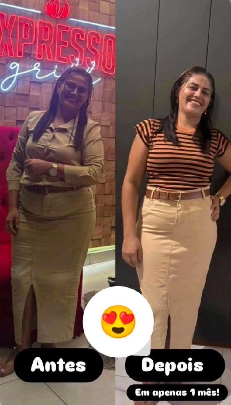 Antes e depois de cliente 14