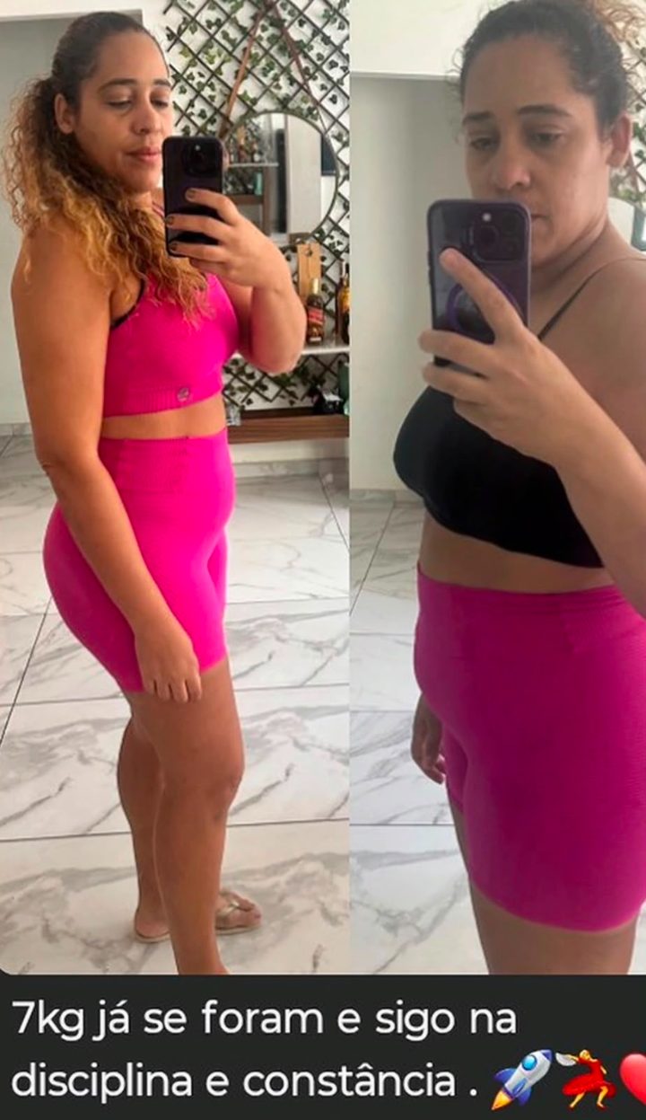 Antes e depois de cliente 15