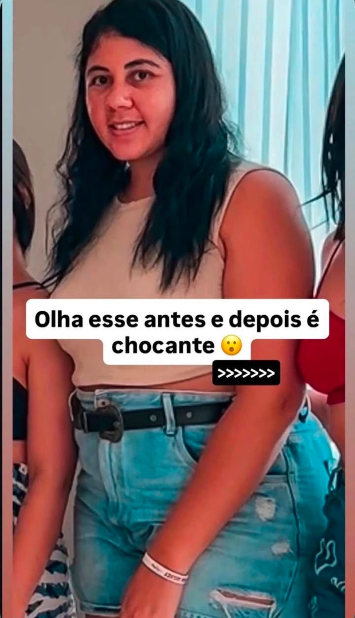 Antes e depois de cliente 16