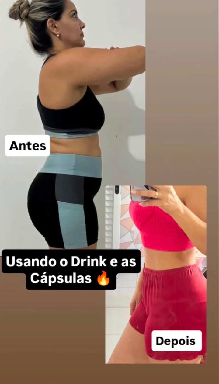 Antes e depois de cliente 19
