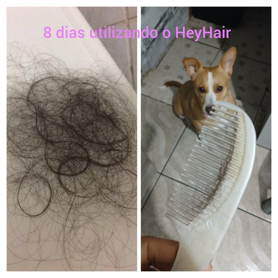 Queda de cabelo após 8 dias de Hey Hair