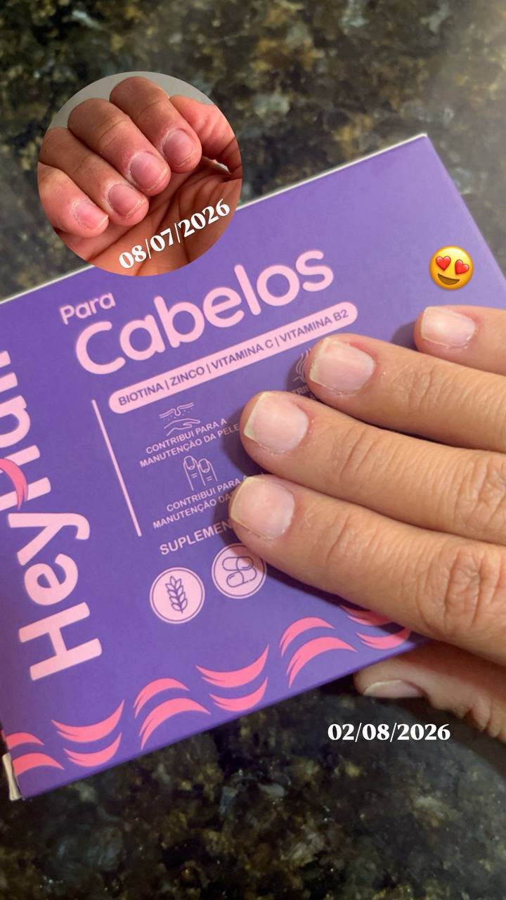 Unhas em 08/07 e 02/08 com Hey Hair